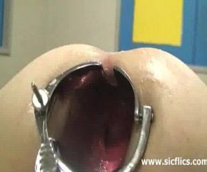 Shocking anal speculum gaping and fisting - 7 min